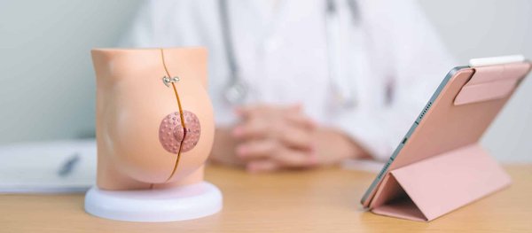 Quels sont les avantages d'opter pour une augmentation mammaire ?